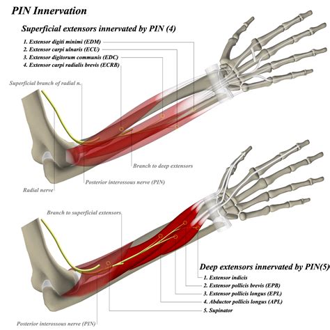 Anterior Interosseous Syndrome