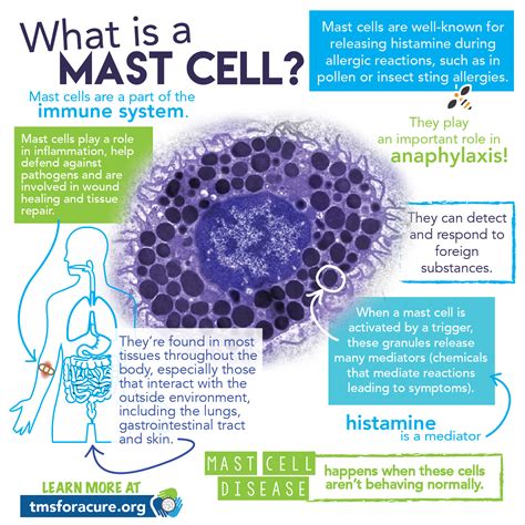 Lyme Sci: The Agony Of Mast Cell Activation Syndrome – IAHPB