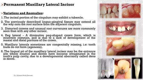 Maxillary lateral incisor. | PDF