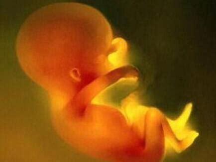 准妈妈必读：胎儿宫内缺氧的几个信号