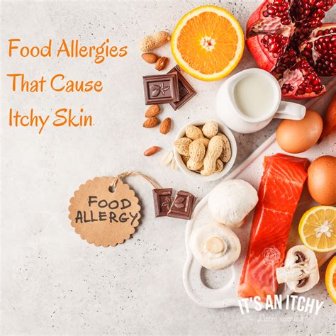 Food Allergy: Causes, Symptoms And Treatment – MYCQVJ