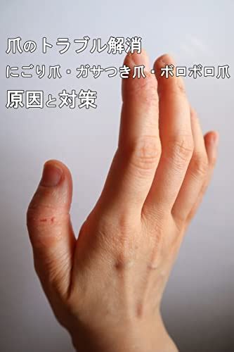 Troubleshoot Your Nails Causes and Solutions for Cloudy Nails Rough ...