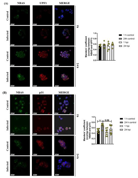 Modulation of NBAS-Related Functions in the Early Response to SARS-CoV ...