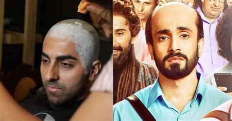 This is how young Indian men are dealing with premature balding