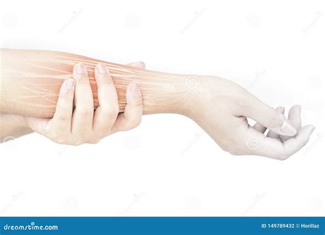 Forearm Muscle Strain Stock Image | CartoonDealer.com #47400019