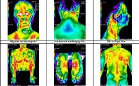 Image result for Body Scan Open