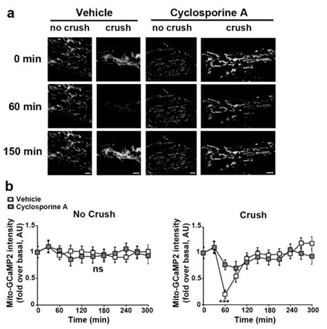 Traumatic and Diabetic Schwann Cell Demyelination Is Triggered by a ...