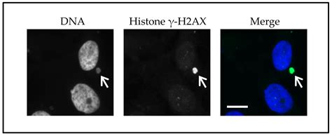 G2/M-Phase Checkpoint Adaptation and Micronuclei Formation as ...
