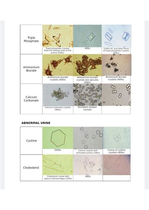 SOLUTION: Urine sediments - Studypool