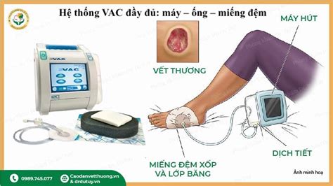 Image result for Parts of DFR Arduino Microcontroller