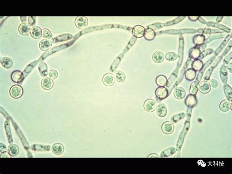 生物界中的庞大类群：真菌王国的那些事_植物