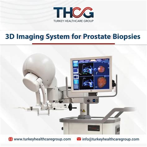 3D Imaging System for Prostate Biopsies - Turkey Health Care Group
