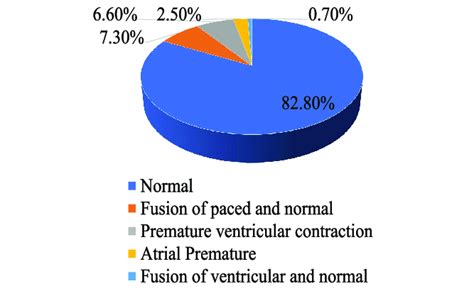 Labels of MIT-BIH Dataset 的图像结果