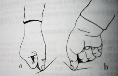 肾5个叩击痛点图,肾压痛点位置示意图,肾区叩击图_大山谷图库