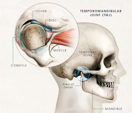 How to Treat Temporomandibular Joint Syndrome (TMJ)