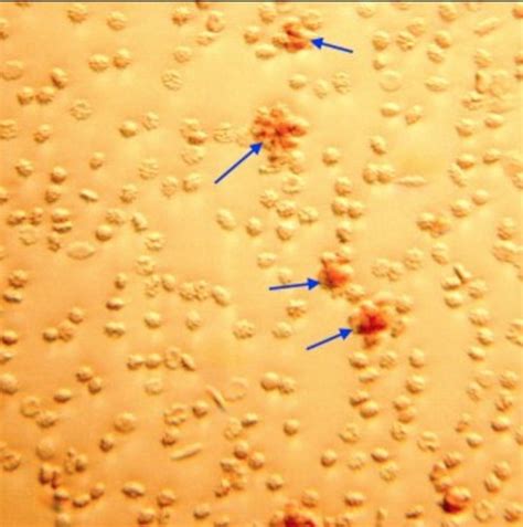 Image result for Fetal Bleed Screen Kit Parallel Testing