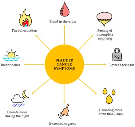 Bladder Cancer Basic Study and Current Clinical Trials