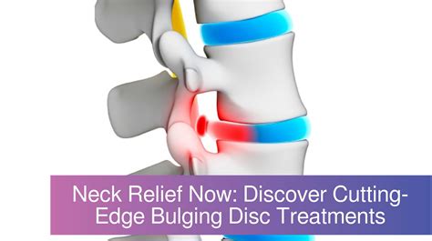 Introducing Revolutionary Neck Bulging Disc Treatment: A Comprehensive ...