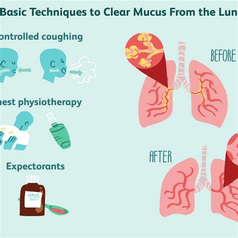 How do you throw up mucus? [2025] | QAQooking.wiki