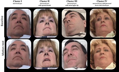 Furrowed Brow Meaning