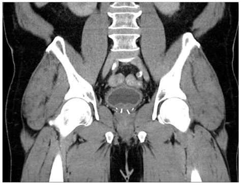 Contemporary Review of Multimodality Imaging of the Prostate Gland