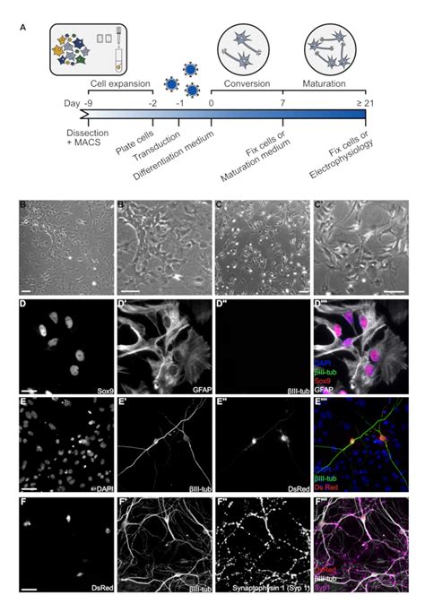 Image result for Astrocyte Neuron Reprogramming