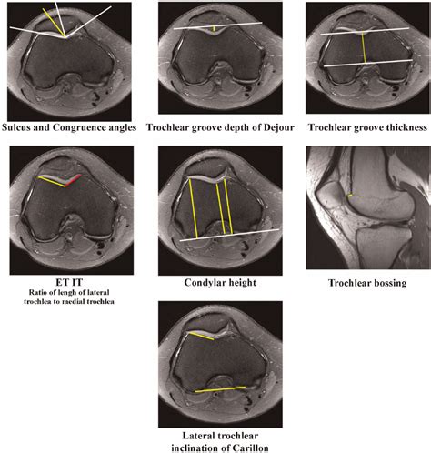 Image result for Trochlear Function