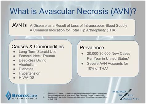 What Is Avascular Vascular at Andrea Burnside blog