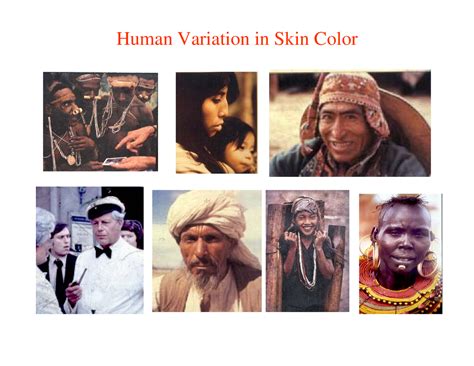 Image result for Continuous Variation Skin Color