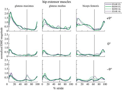 Image result for Muscle Activity EMG