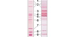 Image result for Sturt Hall Encoding/Decoding
