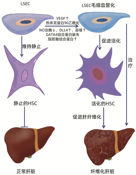 肝窦内皮细胞与肝纤维化的关系