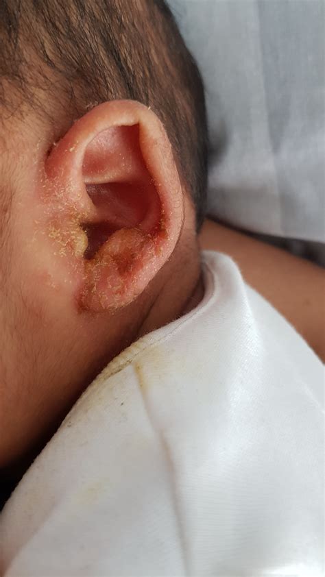 Crusty Stuff Behind Ears