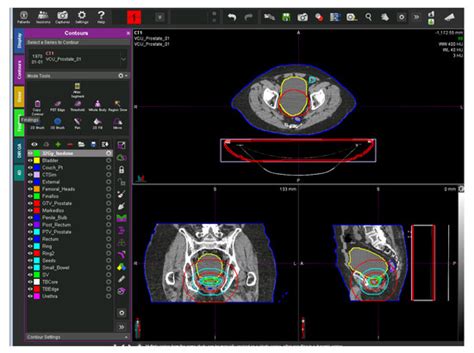 Integrated Natural Language Processing and Machine Learning Models for ...