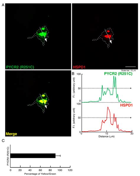 Hypomyelinating Leukodystrophy 10 (HLD10)-Associated Mutations of PYCR2 ...