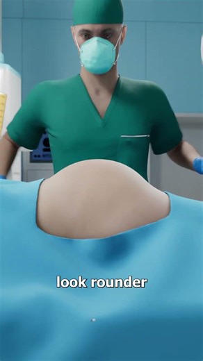 Why Rich People Inject Dead People’s Fat 😬