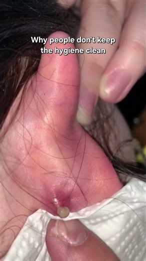 Why people don't keep the hygiene clean