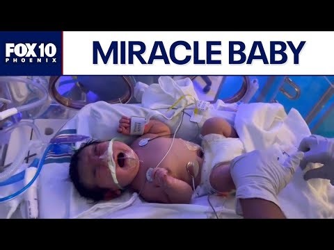 Mother delivers healthy baby after it formed behind ovarian cyst