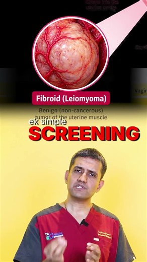 uterus fibroids treatment Bina bachedaani nikaale | with lasers and angiography