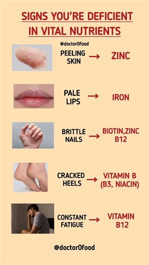 Signs You’re Deficient in Vital Nutrients | Hidden Vitamin & Mineral Deficiencies #healthylifestyle