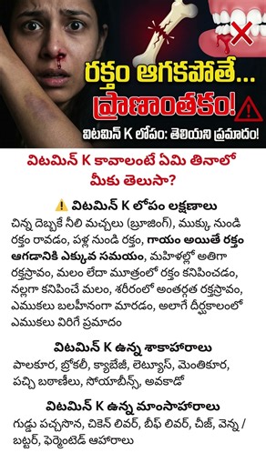 Vitamin K Deficiency Symptoms | Best Vitamin K Foods for Vegetarians & Non-Vegetarians #vitamink