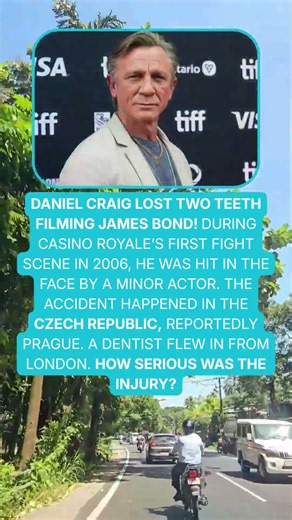 🦷🎬 Daniel Craig’s James Bond Fight Scene Took a Painful Turn! 💥😱