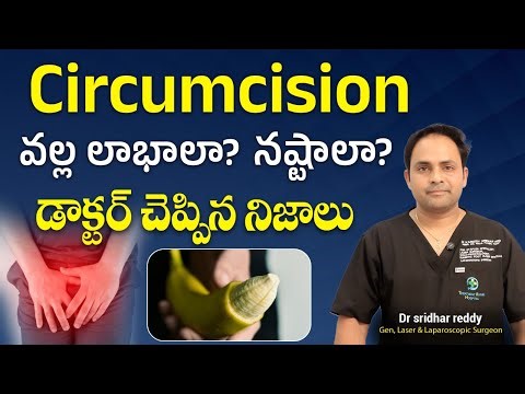 Circumcision Pros and Cons Clearly Explained by Expert | Circumcision Surgery Facts | TRH