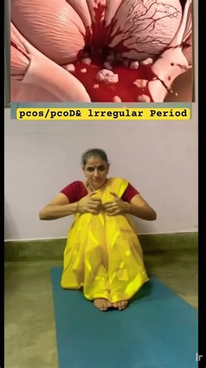 🧘‍♀️ PCOS / PCOD & Irregular Periods?