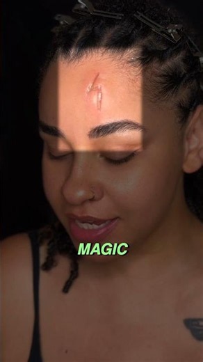 What is SCAR liquid? 🩸🧪