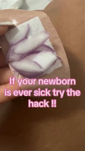 🧅✨The Onion Foot Hack—Does It Really Work?When your baby gets sick, you feel helpless—watching them struggle with congestion, fever, or a runny nose is heartbreaking. But what if relief was as simple as an onion?💨 | Why Feet? The Reflexology Connection :Your feet aren’t just for walking—they’re connected to major organ systems! In reflexology, the soles are packed with nerve endings linked to the…- Lungs & sinuses (helps with congestion)- Immune system (boosts detoxification)- Lymphatic system
