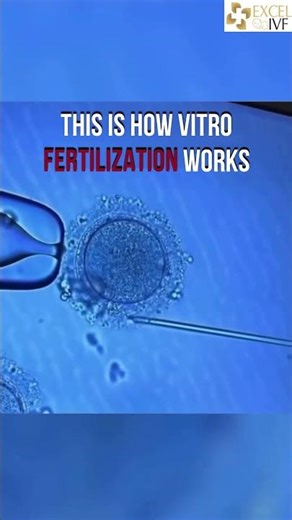 How are embryos actually made in an IVF lab? Dr Rhythm Gupta - IVF Specialist at Excel IVF