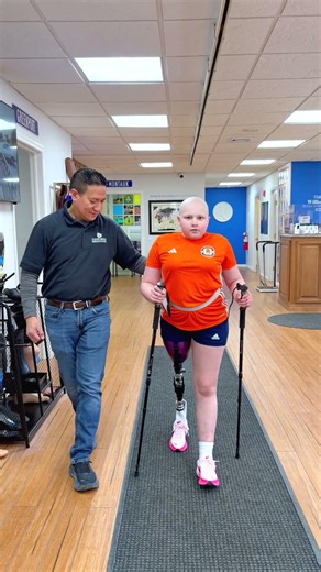 Kaelyn's Progress Using an AK Prosthetic Leg