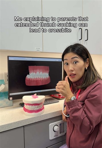 Caption Thumb sucking and pacifiers bring comfort 💛 However, when they last too long, they can affect not just teeth, but jaw development also. Early in my training, I learned children simply needed to stop by age 4. After many years in practice, I now recommend beginning to gently wean around 12 months to stay well ahead of potential effects like crossbite. This isn’t just research, it’s what I see every day. As kids grow, habits become harder to break. Early, gentle prevention truly makes all