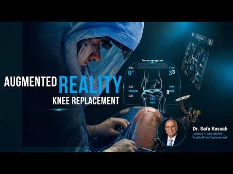 Dr. kassab on CBS Detroit | Augmented Reality Knee Replacement | Dr. Kassab | OSOC